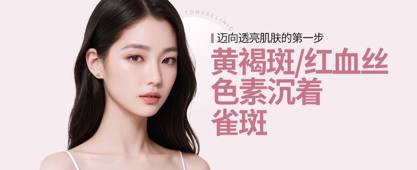 모바일 이미지