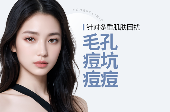 PC 이미지