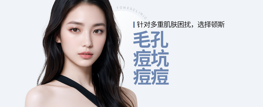 모바일 이미지