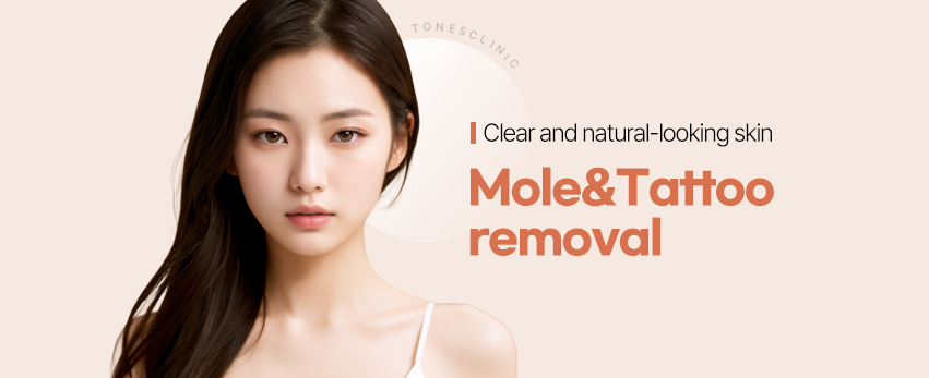 SPOT & TATTOO REMOVAL