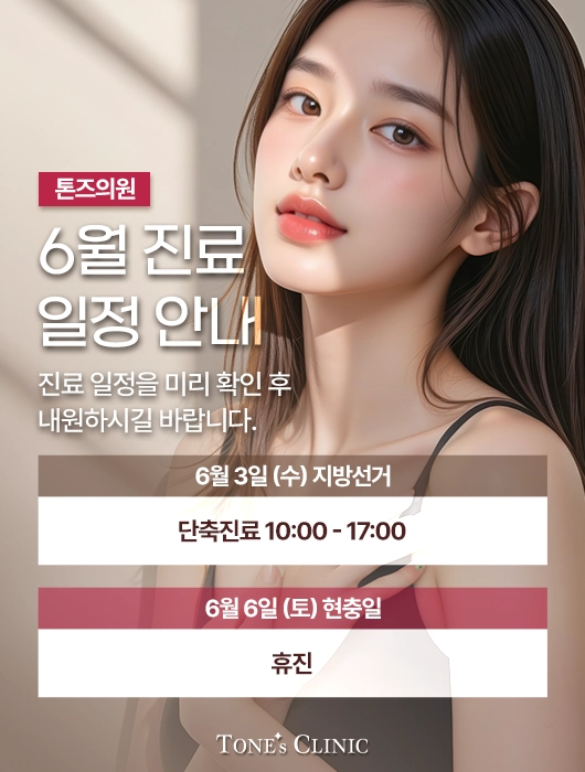 팝업