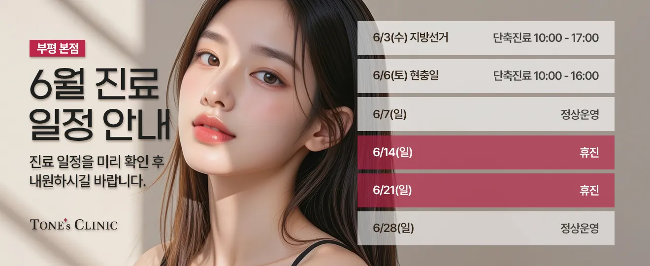 팝업