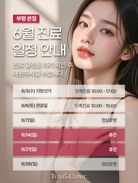 팝업
