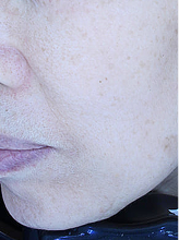 피코슈어+줌패스