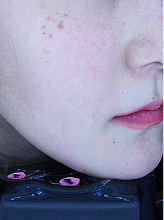 피코슈어+더마리쥬비+더마 홍조2파장